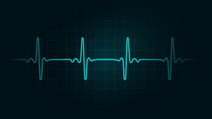 Pulse rate Line on green chart background of monitor. Illustration about heart rate and Cardiogram monitor.