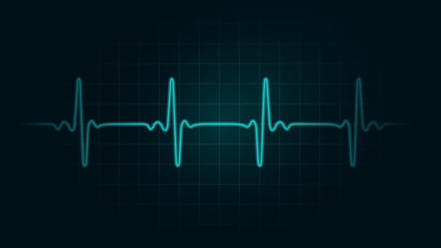 Pulse rate Line on green chart background of monitor. Illustration about heart rate and Cardiogram monitor.