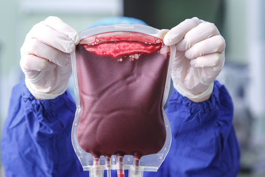 Hands of a medical worker holding a bag of donor blood