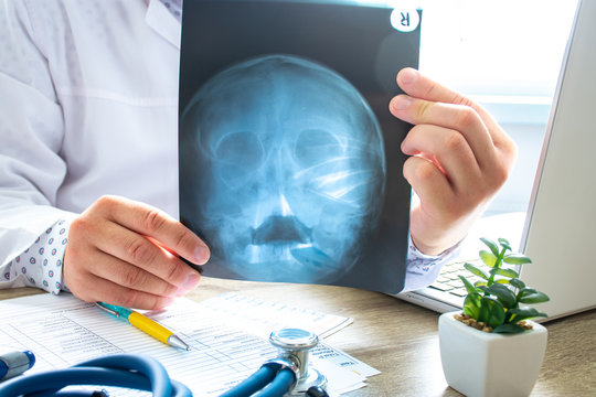 Doctor examines x-ray scan of head and skull near computer during work and patient advice in office. Diagnostics of diseases of ear, nose and throat, adenoids, abnormalities of skull, brain, bones