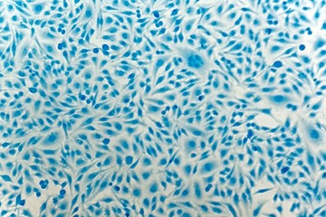HeLa cervical cancer cells