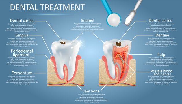 Dental treatment vector diagram education medical anatomy poster infographics
