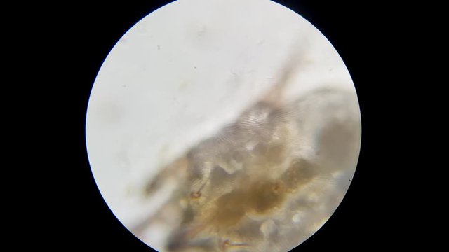 Otodectes cynotis, also known as an ear scabies. Ear swab of a cat's ear under microscope