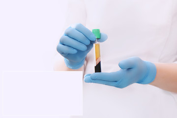 PRP therapy. Medical vial in doctor's hands