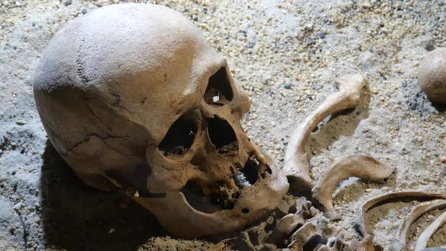 The human skull lies on small stones.