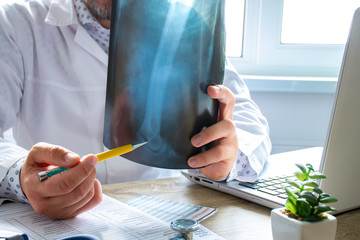 Doctor examines x-ray scan of knee near computer during work and patient appointment in office. On...