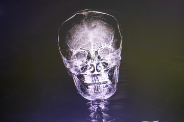  Skull head x-ray image