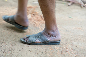 Close up of man in Black slippers feet standing at the backyard