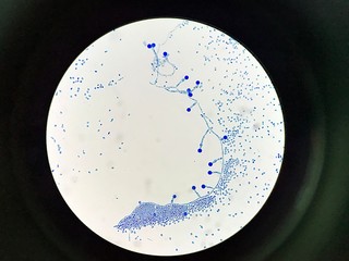 camydospore of cannida albicans