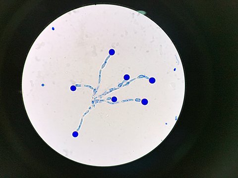 camydospore of cannida albicans