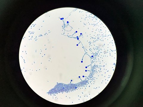 camydospore of cannida albicans