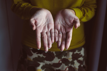 Woman with hand removes flaky skin,Health care skin concept,Close up