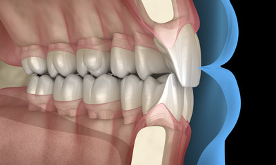 Healthy human teeth with normal occlusion, 3D Illustration