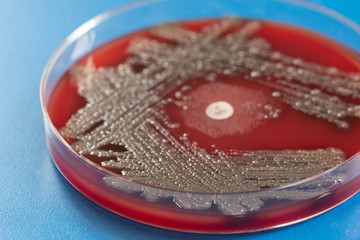 Sowing human feces in a petri dish