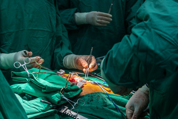 Close up group of surgeons in Surgery operating room. Medical team of surgeons doing surgery in...