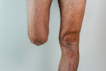 rugged man with an amputated leg isolated on White background