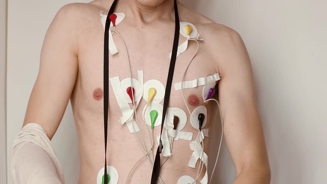 young thin man takes off shirt on white background. holter monitor is connected to his chest underneath. wires are attached to skin with patch. recording electrical cardiogram of heart for 24 hours