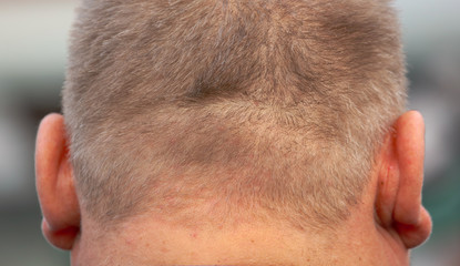 Nape and ears of a fat man