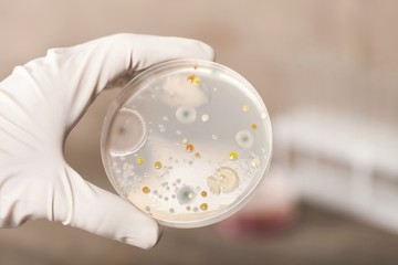 Microbiology laboratory test in scientist hand on background