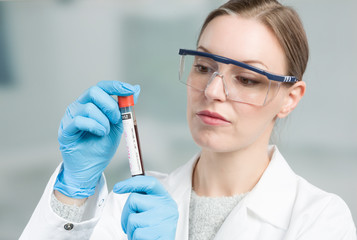 woman with medical gloves is holding a blood probe