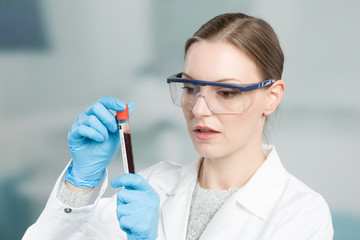 woman with medical gloves is handling a blood probe in a test tube