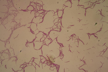 Bacillus anthracis Milzbranderreger unter dem Mikroskop 200x