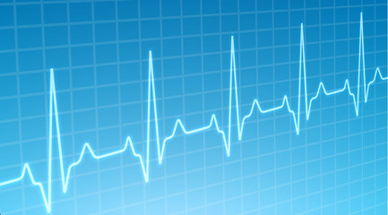 ECG heartbeat monitor, cardiogram heart pulse line wave. Electrocardiogram medical background