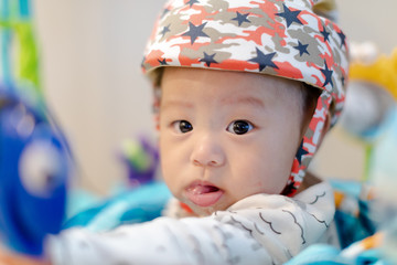 Adorable 4 month old asian baby with an orthopedic helmet