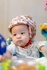 Adorable 4 month old asian baby with an orthopedic helmet