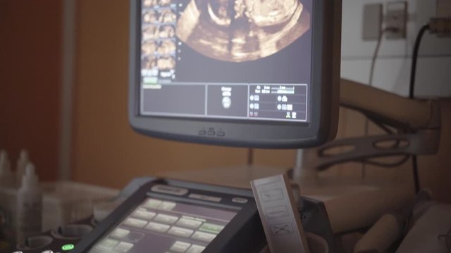 Revealing Shot of an Ultrasound Machine Showing a Sonogram of a Live Fetal Movement