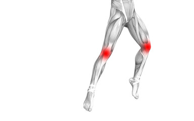 Obraz premium Conceptual knee human anatomy with red hot spot inflammation or articular joint pain for leg health care therapy or sport muscle concepts. 3D illustration man arthritis or bone osteoporosis disease