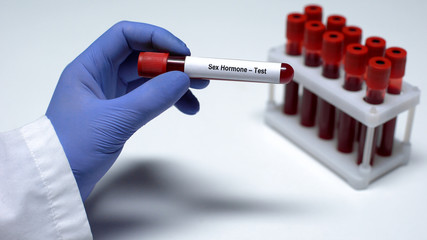 Sex Hormone, doctor showing blood sample in tube, lab research, health checkup