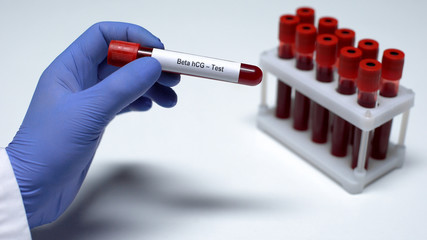 Beta hCG test, doctor showing blood sample in tube, lab research, health checkup