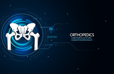 Medical orthopedic abstract background. Treatment for orthopedics traumatology of hip and pelvis bones and joints injury. Medical presentation, hospital. Vector illustration