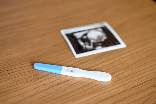  Pregnancy test with ultrasound