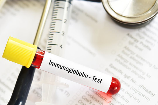 Blood sample tube for Immunoglobulin level test, diagnosis for immunodeficiency disease