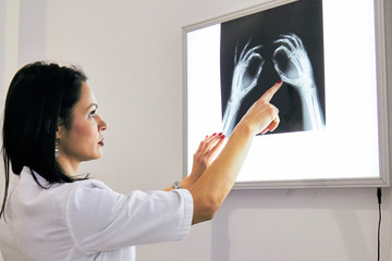 Smart woman doctor check hand bones film x - ray image from machine.