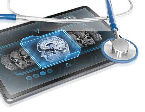 Modern medical tablet displaying brain scan 