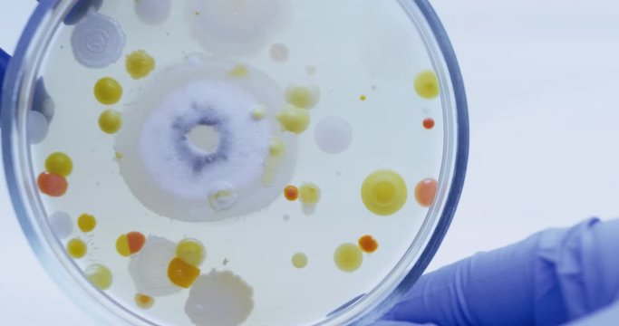 Bacterial test for the purity of drinking water. Closeup of a petri dish with colored colonies of bacteria. A large round mold grew in the center of the petri dish.