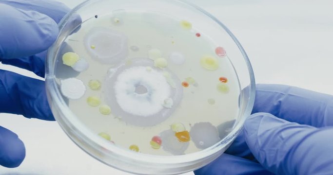 A close-up of a Petri dish with bacterial colonies, which the scientist analyzes in a sterile cabinet. Among the color colonies of bacteria, a large white mold has grown.