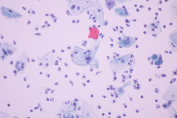 Obraz na płótnie Canvas View in microscopic of normal human cervix cells with free space background.Squamous metaplasia cell lining of vagina in pap smear slide.Cytology and pathology laboratory