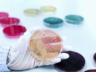 Mannitol salt agar (MSA Agar) in Petri dish used selective and differential growth medium in microbiology cultured Gram-positive bacteria (Staphylococcus and Micrococcaceae) Handle in scientist hands.