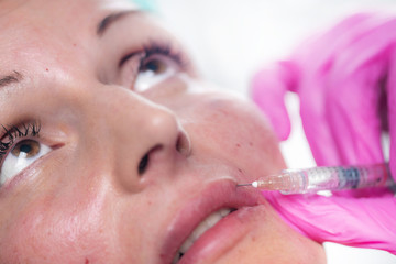 Hyaluronic Acid Fillers for Lips