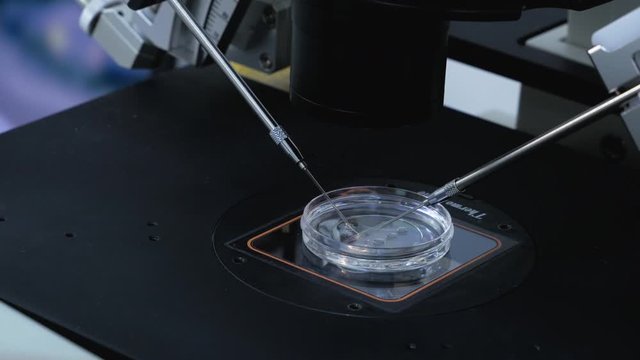 Стоковое видео  Artificial insemination. A control check of the in vitro fertilization process in a Petri dish using the BMP manipulator in the laboratory.