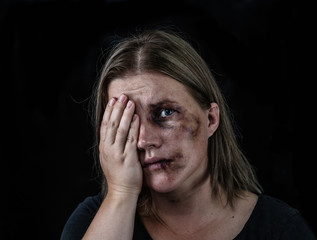 Portrait of the woman victim of domestic violence and abuse. Isolated on dark background. Empty...