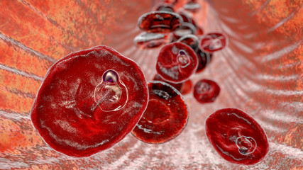 The malaria-infected red blood cell. 3D illustration showing malaria parasite Plasmodium ovale in the stage of ring-form trophozoite