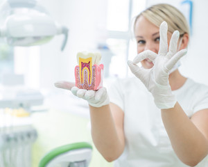 Anatomy of a dental model concept of a dentist cross section for education. The dentist holds a...