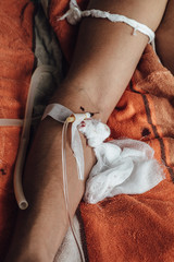 Obraz premium Hand of a patient with medical drip in hospital. Patient with drip receiving a saline solution. patient lying on bed in hospital.