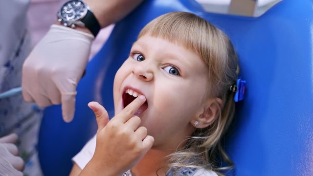 Little child in stomatology chair points at the ill tooth with a finger - close up video. Healthy teeth concept video.