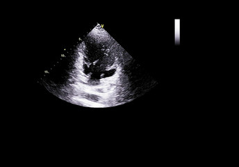 Fototapeta premium Screen of echocardiography (ultrasound) machine.